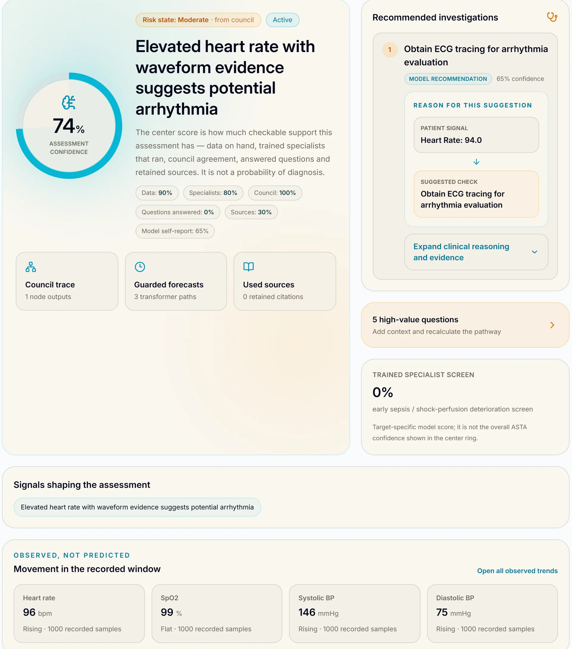 ASTA command view: a generated assessment reading elevated heart rate with waveform evidence suggests potential arrhythmia, a 74 percent assessment-confidence ring with data, specialists and council scores, a recommended ECG investigation with model reasoning, and observed vital movement tiles.